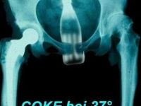 Coke