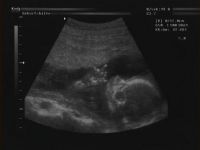 Stinkefinger Ultraschall